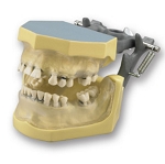 110 Articulated Periodontal Soft Clear Gingiva Model with Calculus on Natural Root Teeth